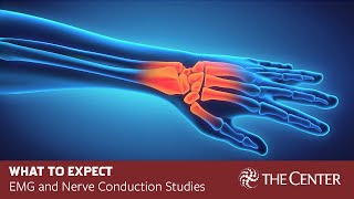 What to Expect During Nerve Conduction Studies and EMG Tests [upl. by Ahsimal493]