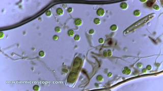 Pond Scum Under the Microscope [upl. by Agni202]