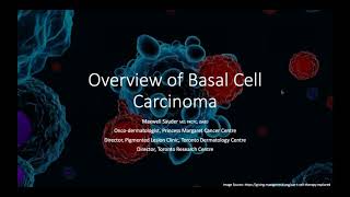 Basal Cell Carcinoma What Patients Need to Know [upl. by Findlay]