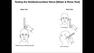 Interpreting the WeberRinne Tests EXPLAINED [upl. by Ollopa]