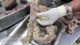 Introduction Neuroanatomy Video Lab  Brain Dissections [upl. by Crudden730]