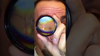 How to Do Your Own Fundus Exam [upl. by Ymrej]