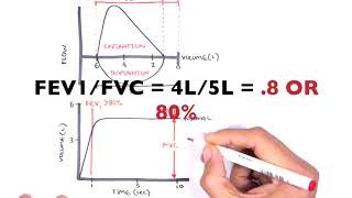 Understanding Spirometry  Normal Obstructive vs Restrictive [upl. by Fari]