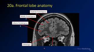 Neuroradiology review  brain gyral anatomy [upl. by Pascale]