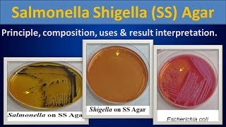 Salmonella shigella SS Agar [upl. by Solita]