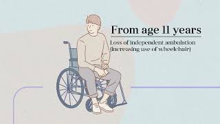 What parents need to know about Duchenne muscular dystrophy [upl. by Yetsirhc]