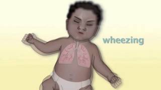 Common Pediatric Respiratory Problems by M Kleinman  OPENPediatrics [upl. by Einnaffit913]