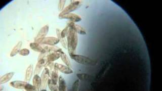 Paramecium Under the Microscope [upl. by Josiah]